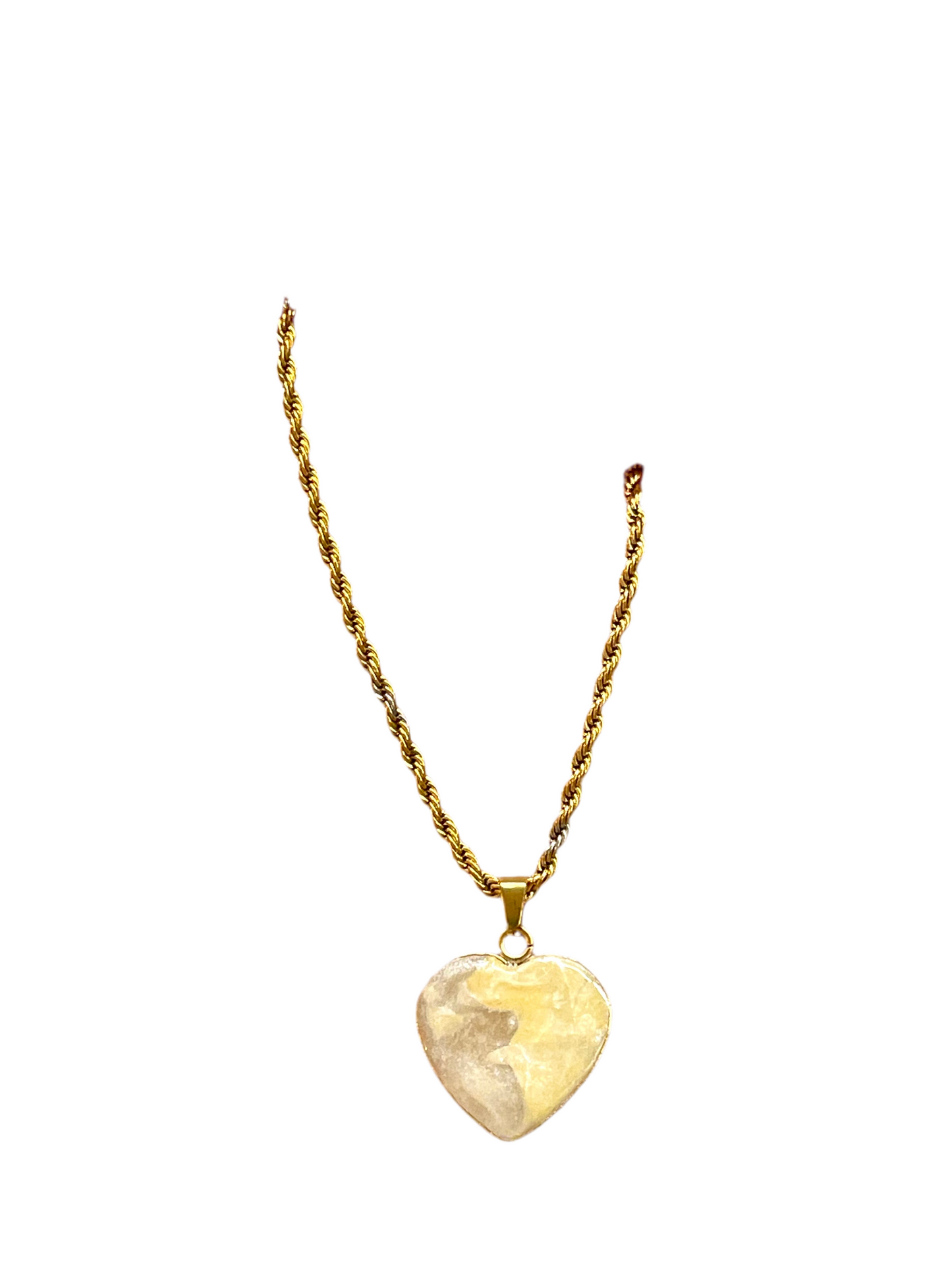 πΆπππππππ at ππ’ππedema