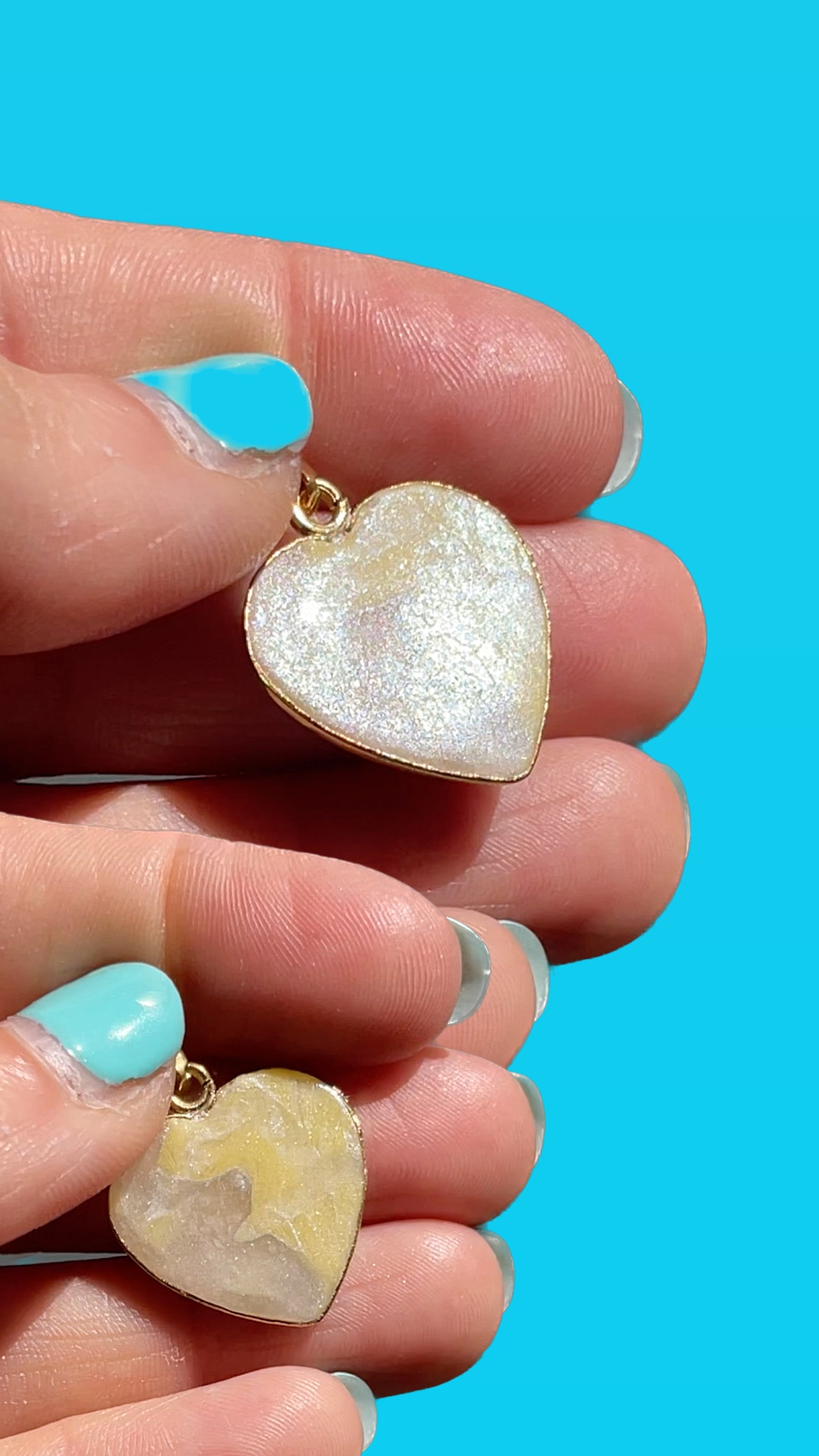 πΆπππππππ at ππ’ππedema