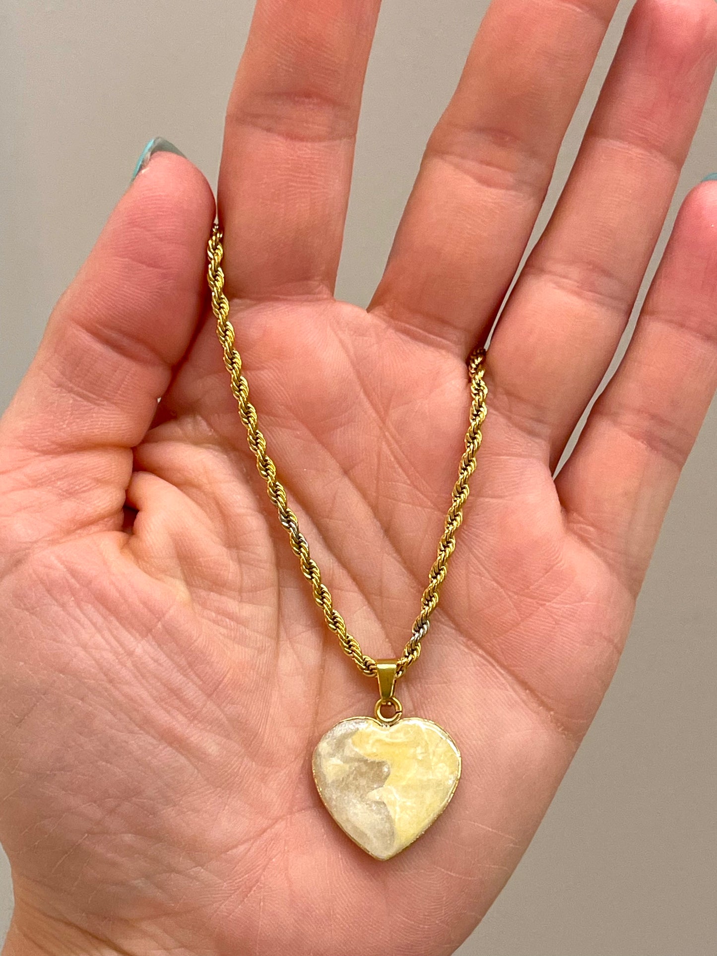 πΆπππππππ at ππ’ππedema